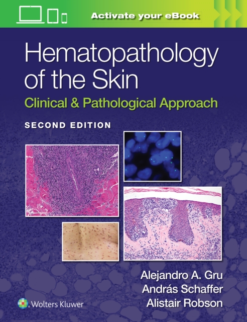 Hematopathology of the Skin