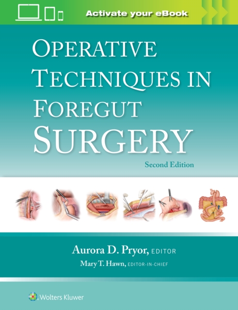 Operative Techniques in Foregut Surgery