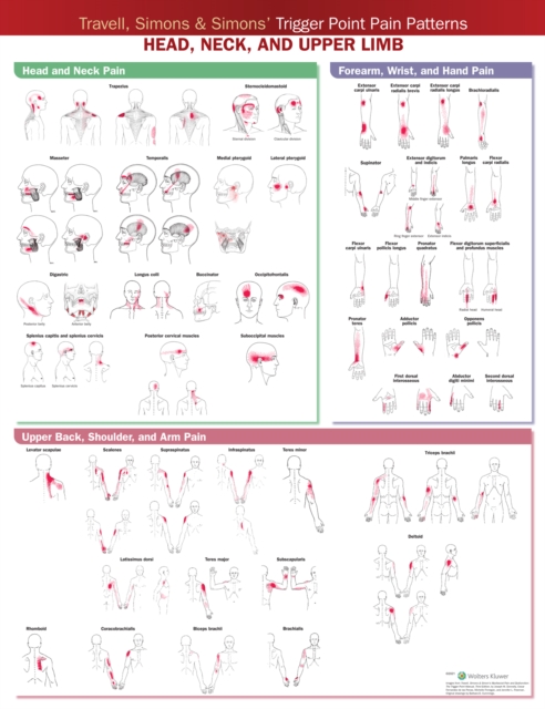 Travell, Simons & Simons' Trigger Point Pain Patterns Wall Chart