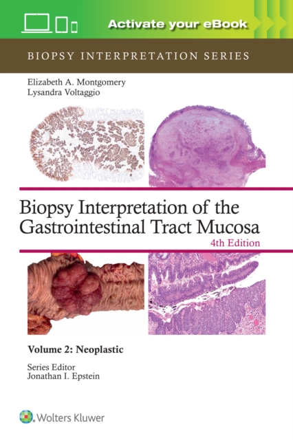 Biopsy Interpretation of the Gastrointestinal Tract Mucosa Volume 2