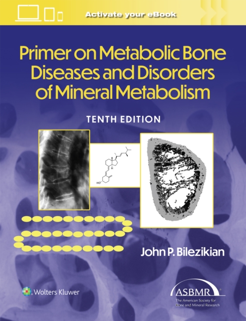 Primer on the Metabolic Bone Diseases and Disorders of Mineral Metabolism