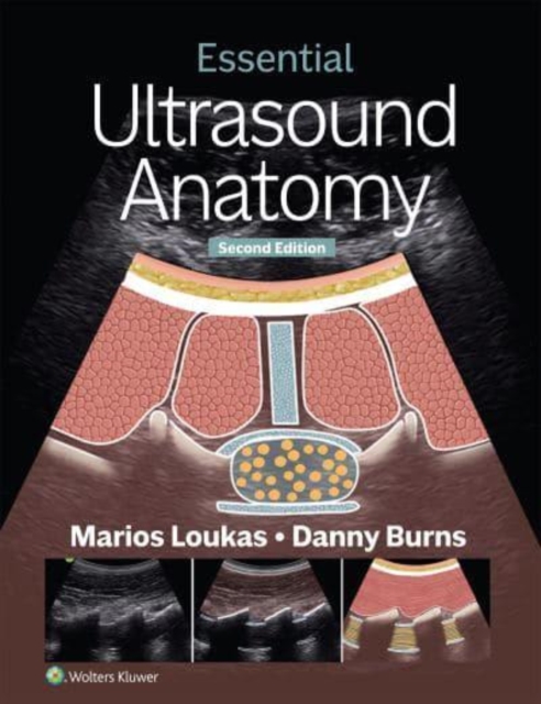 Essential Ultrasound Anatomy