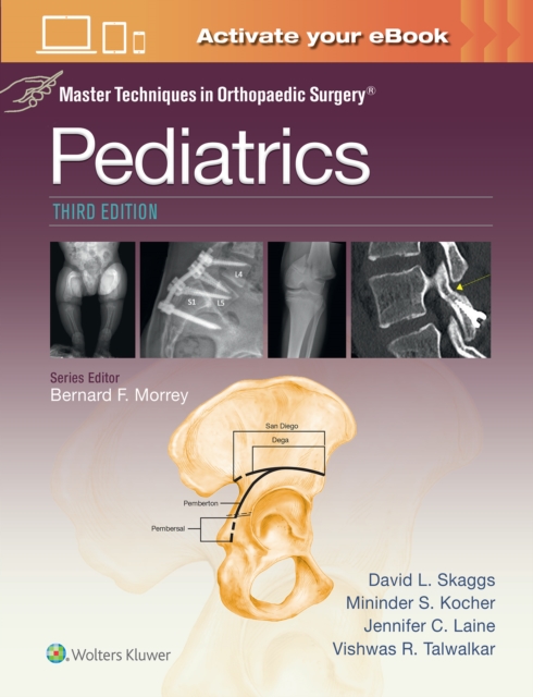 Master Techniques in Orthopaedic Surgery: Pediatrics Print + eBook with Multimedia
