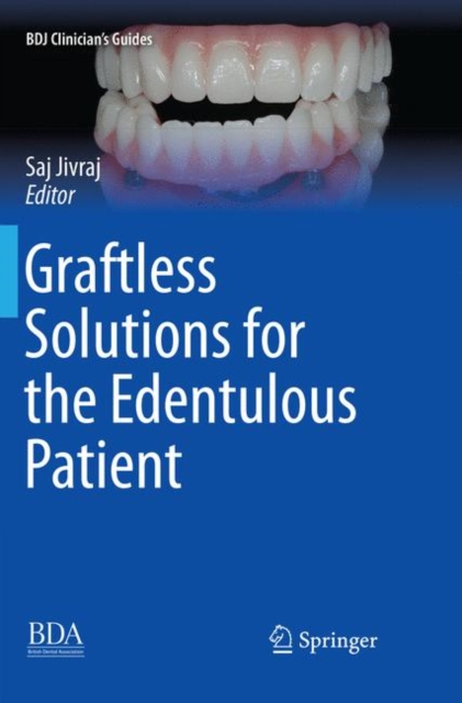 Graftless Solutions for the Edentulous Patient