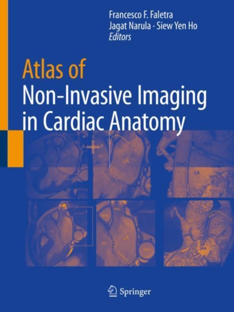 Atlas of Non-Invasive Imaging in Cardiac Anatomy