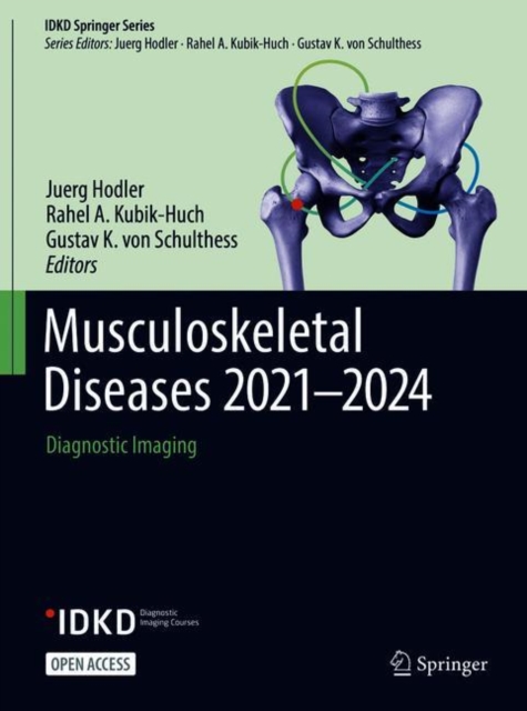 Musculoskeletal Diseases 2021-2024