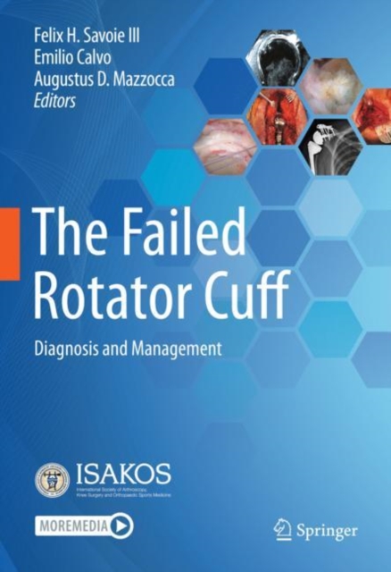 Failed Rotator Cuff
