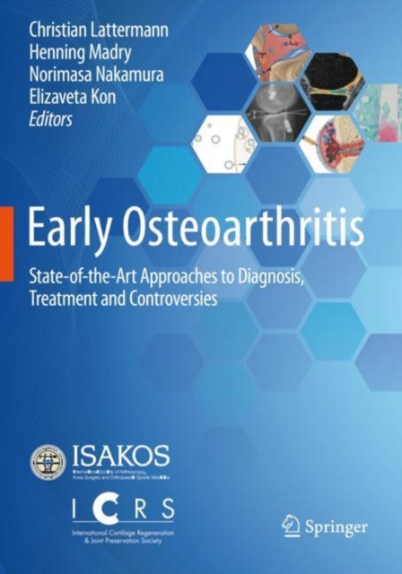 Early Osteoarthritis