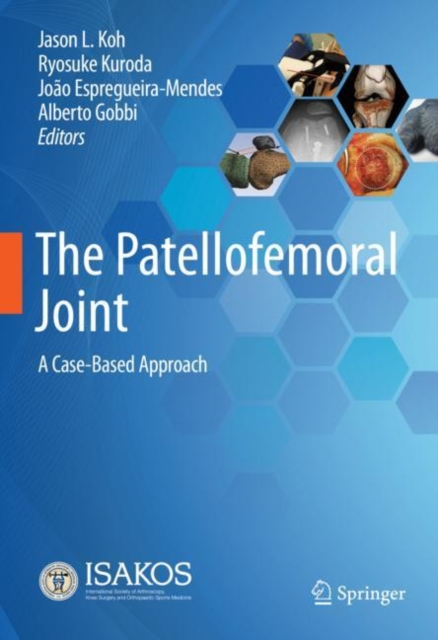 Patellofemoral Joint