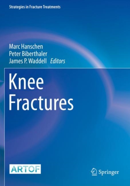 Knee Fractures