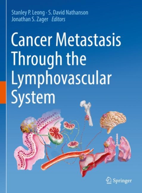 Cancer Metastasis Through the Lymphovascular System