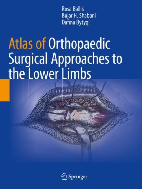 Atlas of Orthopaedic Surgical Approaches to the Lower Limbs