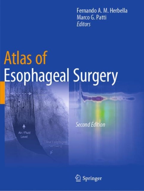 Atlas of Esophageal Surgery