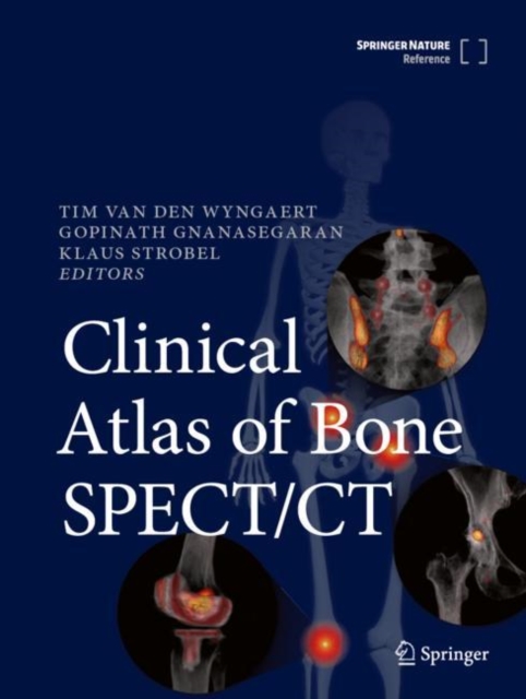 Clinical Atlas of Bone SPECT/CT