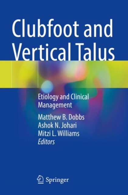 Clubfoot and Vertical Talus