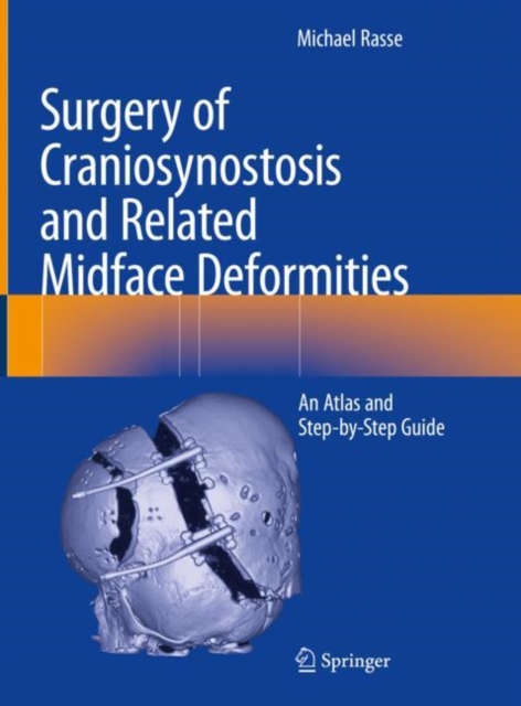 Surgery of Craniosynostosis and Related Midface Deformities