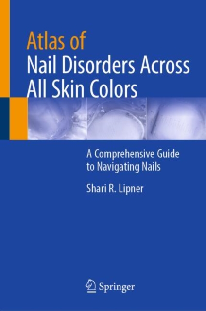 Atlas of Nail Disorders Across All Skin Colors