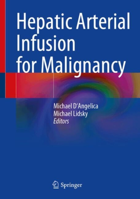 Hepatic Arterial Infusion for Malignancy