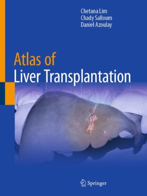 Atlas of Liver Transplantation