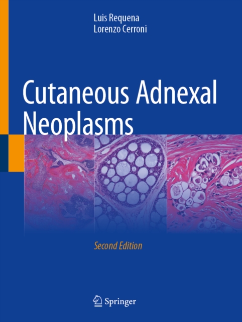 Cutaneous Adnexal Neoplasms