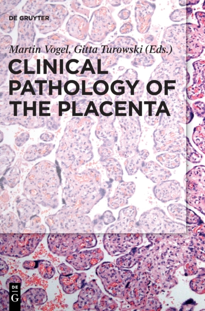 Clinical Pathology of the Placenta