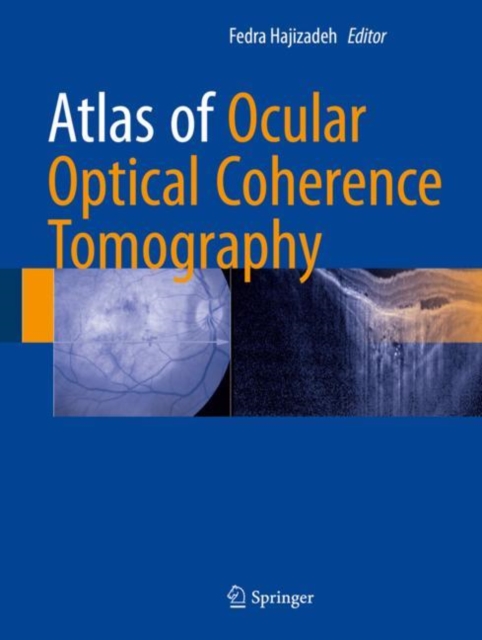 Atlas of Ocular Optical Coherence Tomography