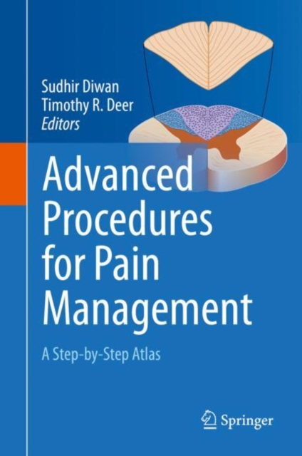 Advanced Procedures for Pain Management