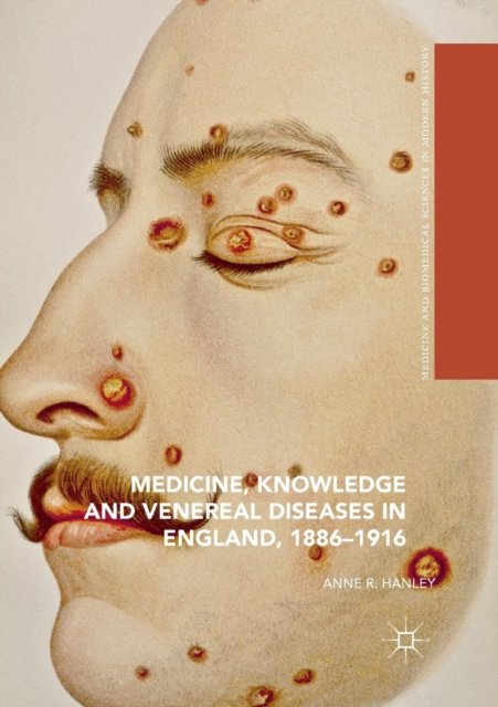 Medicine, Knowledge and Venereal Diseases in England, 1886-1916