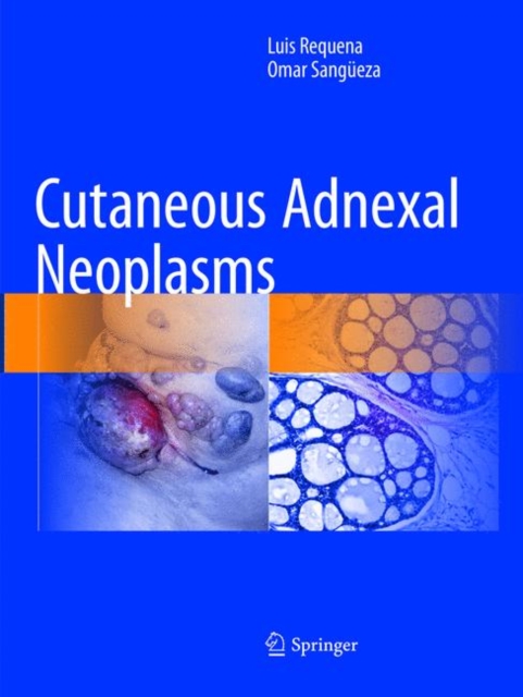 Cutaneous Adnexal Neoplasms