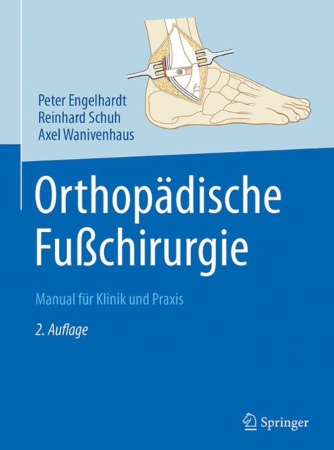 Orthopadische Fuchirurgie