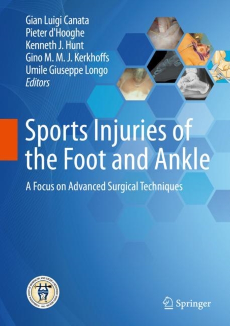 Sports Injuries of the Foot and Ankle