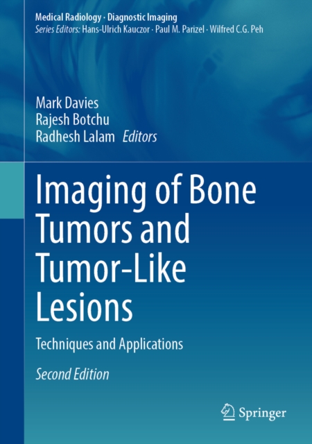 Imaging of Bone Tumors and Tumor-Like Lesions