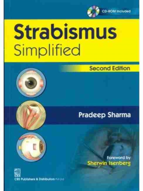 Strabismus Simplified