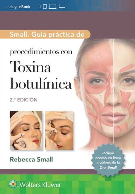 Small. Guia practica de procedimientos con toxina botulinica