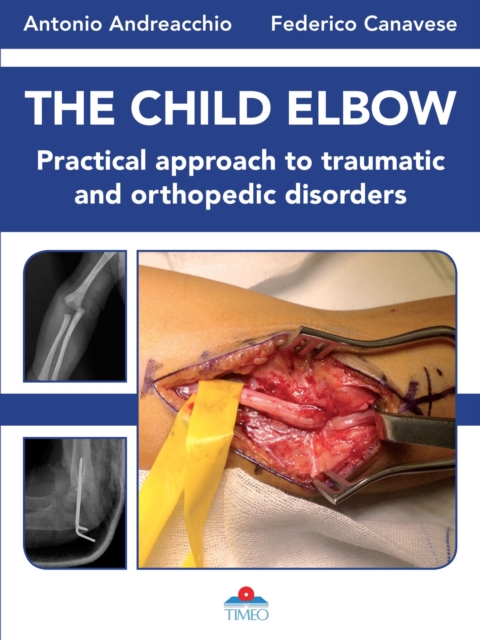 Child Elbow