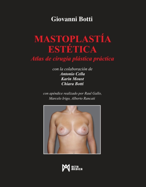 Mastoplastia Estetica