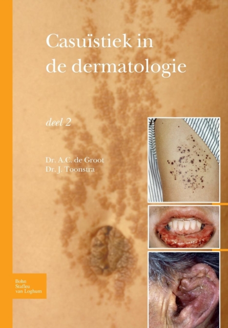Casuistiek in de Dermatologie - Deel 2