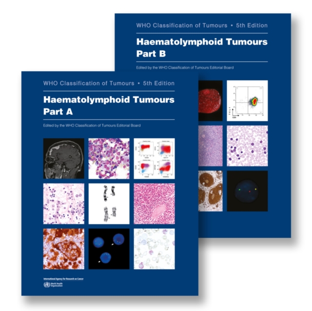 The WHO Classification of Tumours Haematolymphoid Tumours (Volume 11) 5th edition