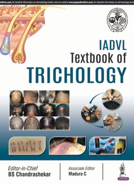 IADVL Textbook of Trichology