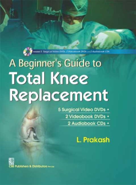 Beginner's Guide to Total Knee Replacement