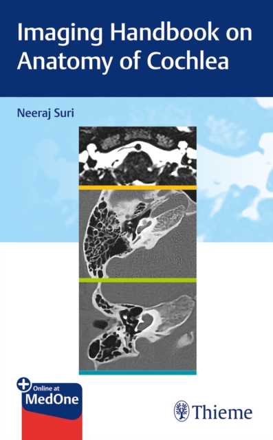 Imaging Handbook on Anatomy of Cochlea