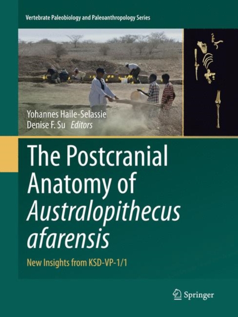 Postcranial Anatomy of Australopithecus afarensis