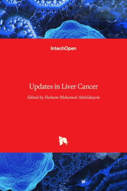 Updates in Liver Cancer