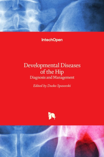 Developmental Diseases of the Hip