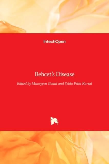 Behcet's Disease