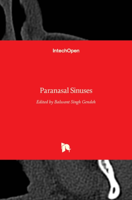 Paranasal Sinuses