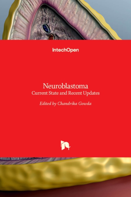 Neuroblastoma