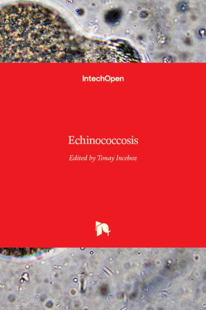 Echinococcosis