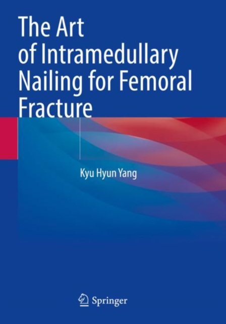 Art of Intramedullary Nailing for Femoral Fracture