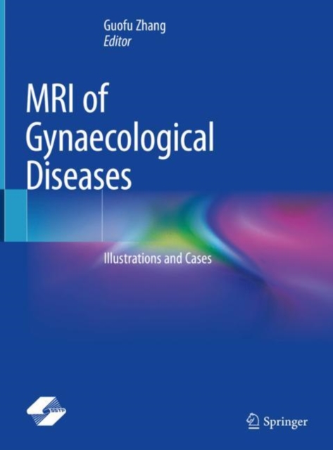 MRI of Gynaecological Diseases